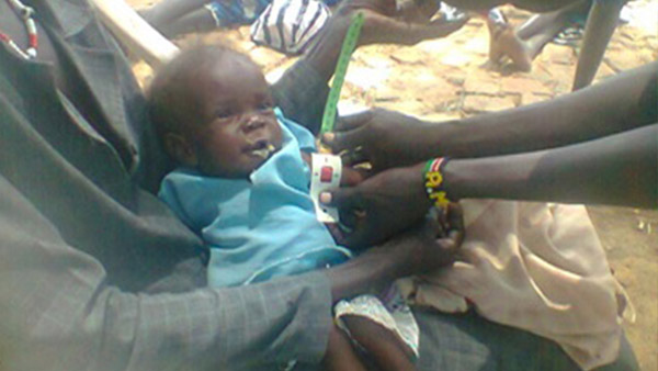 上腕周囲計測帯測定を受ける子ども：重度栄養不良に加え衰弱が激しく入院治療を提供しました（南スーダン）©Word Vision Japan